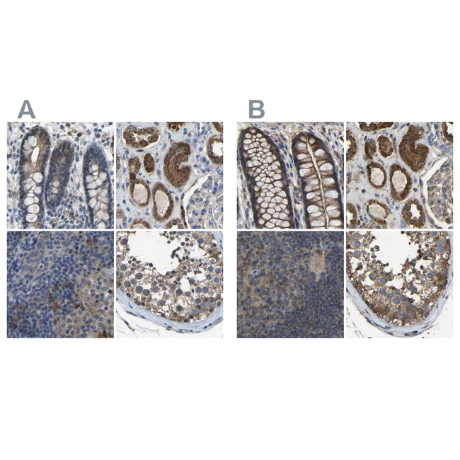 FHIT Antibody in Immunohistochemistry (Paraffin) (IHC (P))