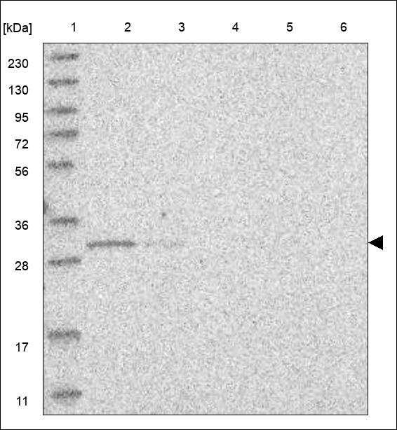 TSSK6 Antibody in Western Blot (WB)