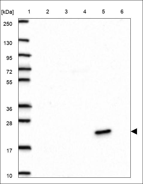Ficolin 3 Antibody in Western Blot (WB)