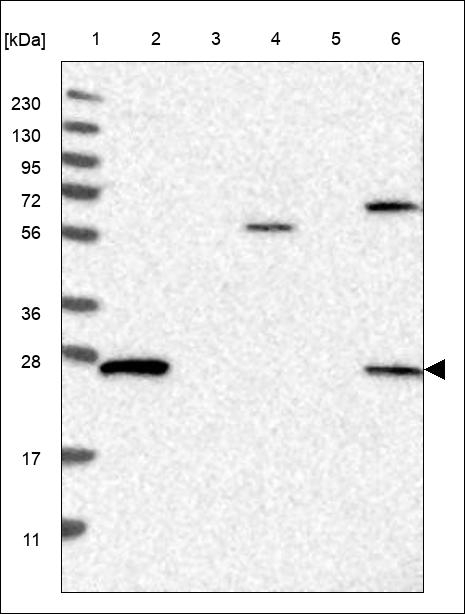 RAB3D Antibody in Western Blot (WB)