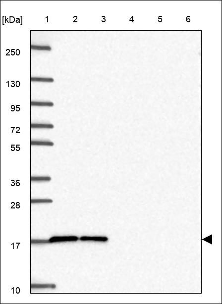 SRP14 Antibody in Western Blot (WB)