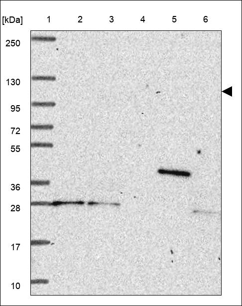 TCIRG1 Antibody in Western Blot (WB)