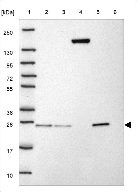 CFHR3 Antibody in Western Blot (WB)
