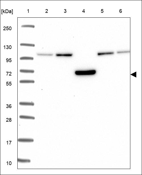 TEKT5 Antibody in Western Blot (WB)