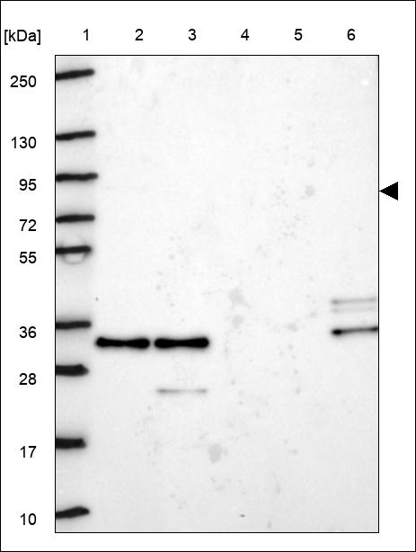 KLHL22 Antibody in Western Blot (WB)