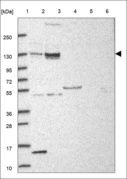 ASXL1 Antibody in Western Blot (WB)