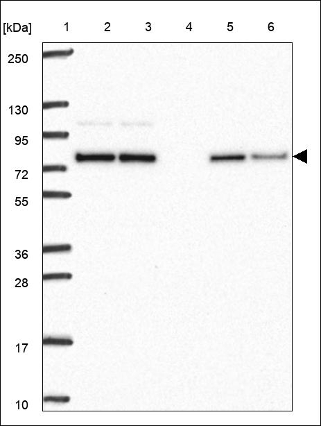 KLHL2 Antibody in Western Blot (WB)