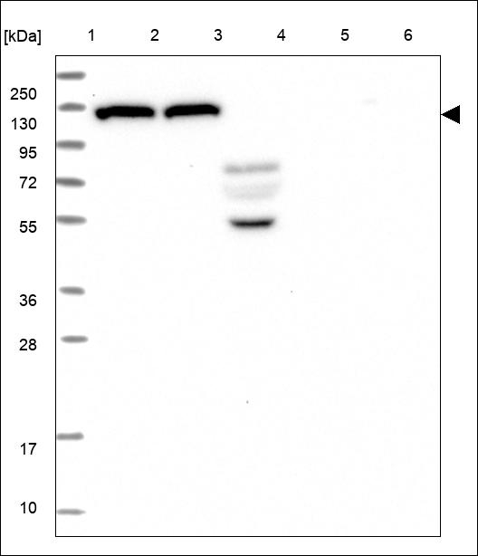 Adenylate Cyclase 6 Antibody in Western Blot (WB)