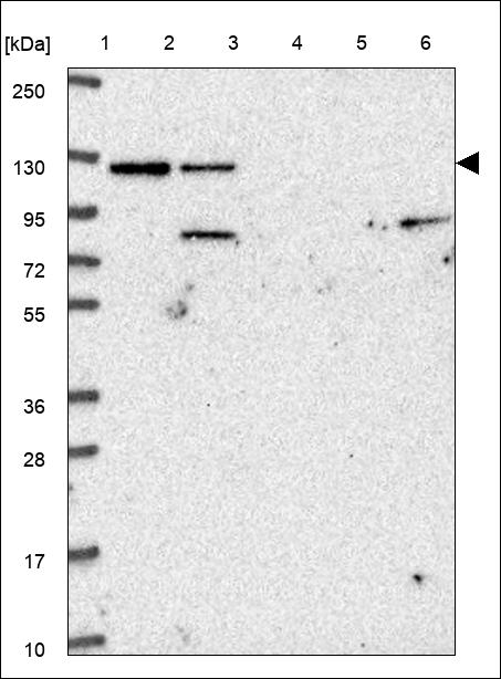 Adenylate Cyclase 6 Antibody in Western Blot (WB)