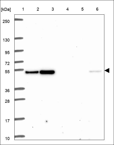 HOXA3 Antibody in Western Blot (WB)