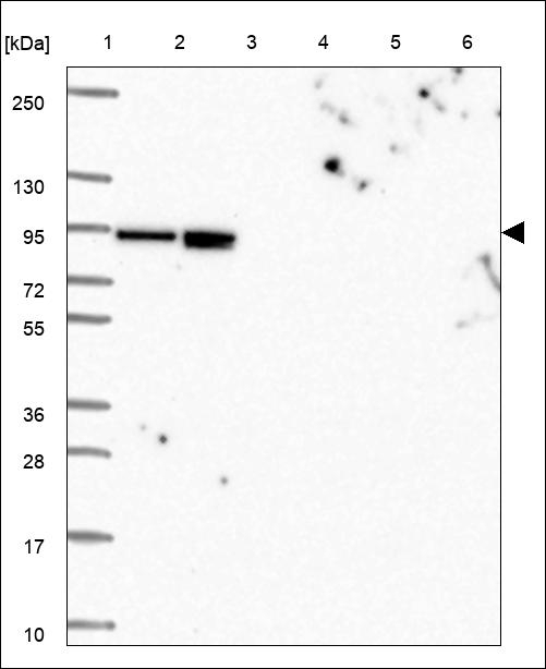 CTNNAL1 Antibody in Western Blot (WB)