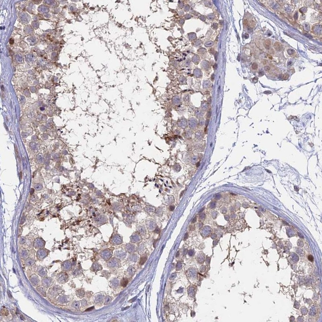 LXR alpha Antibody in Immunohistochemistry (Paraffin) (IHC (P))