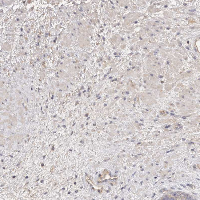 ADAMTS9 Antibody in Immunohistochemistry (Paraffin) (IHC (P))