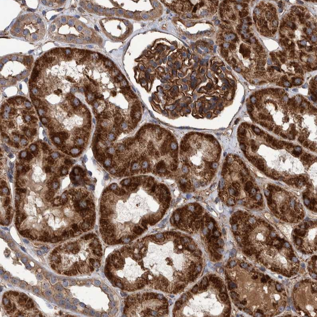 SLC25A10 Antibody in Immunohistochemistry (Paraffin) (IHC (P))