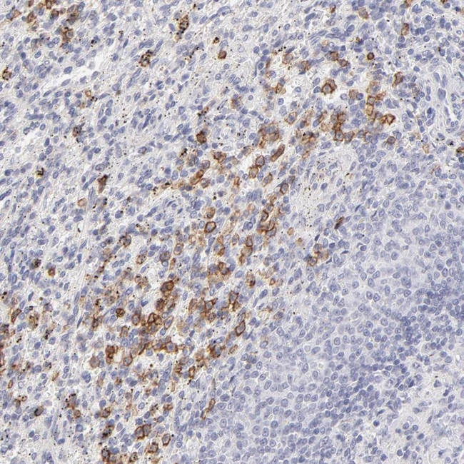 LTB4R Antibody in Immunohistochemistry (Paraffin) (IHC (P))