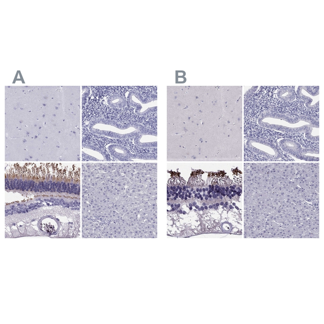 PDE6A Antibody in Immunohistochemistry (Paraffin) (IHC (P))