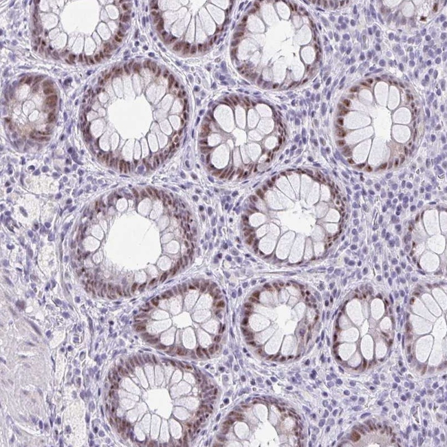 NR1D2 Antibody in Immunohistochemistry (Paraffin) (IHC (P))