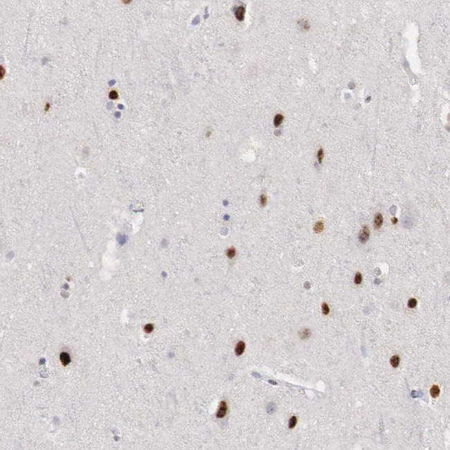 FOXP2 Antibody in Immunohistochemistry (Paraffin) (IHC (P))