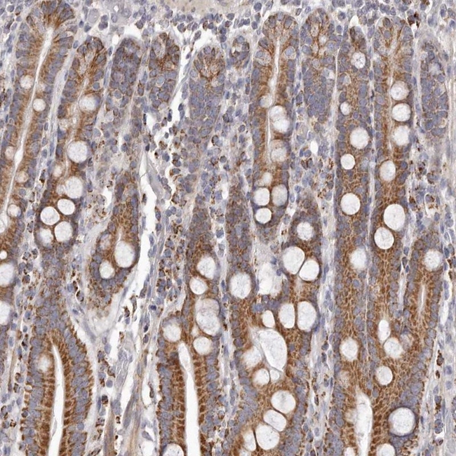 PRMT2 Antibody in Immunohistochemistry (Paraffin) (IHC (P))