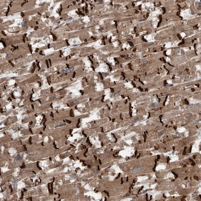 VEGFD Antibody in Immunohistochemistry (Paraffin) (IHC (P))