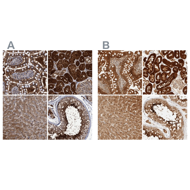 PCYT2 Antibody in Immunohistochemistry (Paraffin) (IHC (P))