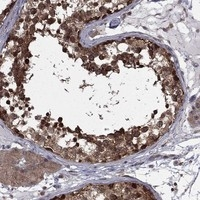NAT13 Antibody in Immunohistochemistry (Paraffin) (IHC (P))