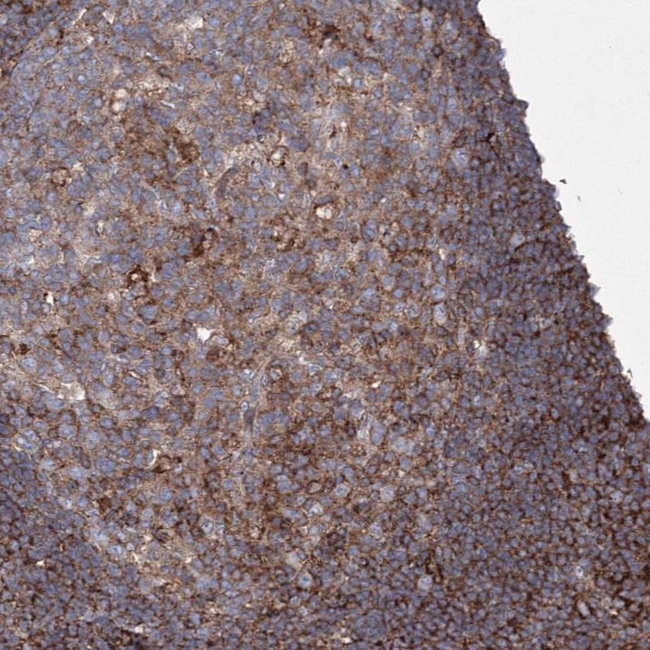 GPR82 Antibody in Immunohistochemistry (Paraffin) (IHC (P))