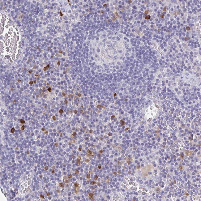 OR2A4 Antibody in Immunohistochemistry (Paraffin) (IHC (P))