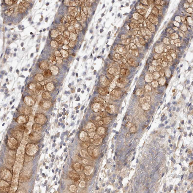 ADAMTS9 Antibody in Immunohistochemistry (Paraffin) (IHC (P))