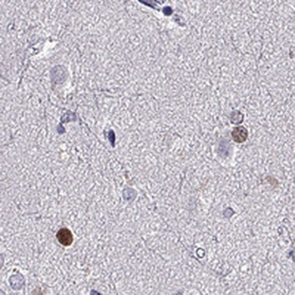 SOX21 Antibody in Immunohistochemistry (Paraffin) (IHC (P))