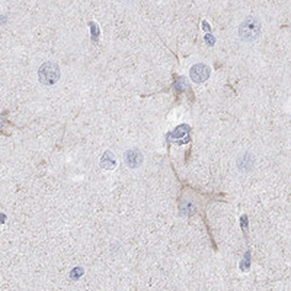 KCNH8 Antibody in Immunohistochemistry (Paraffin) (IHC (P))
