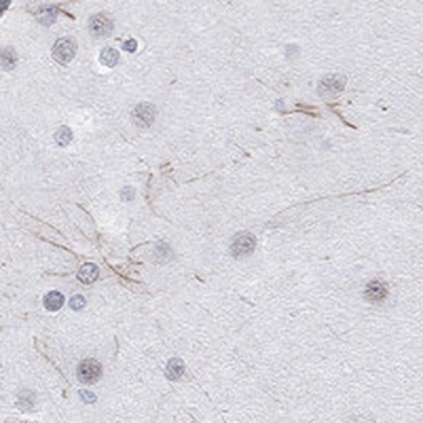 KCNH8 Antibody in Immunohistochemistry (Paraffin) (IHC (P))