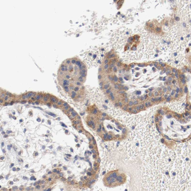 PCSK6 Antibody in Immunohistochemistry (Paraffin) (IHC (P))