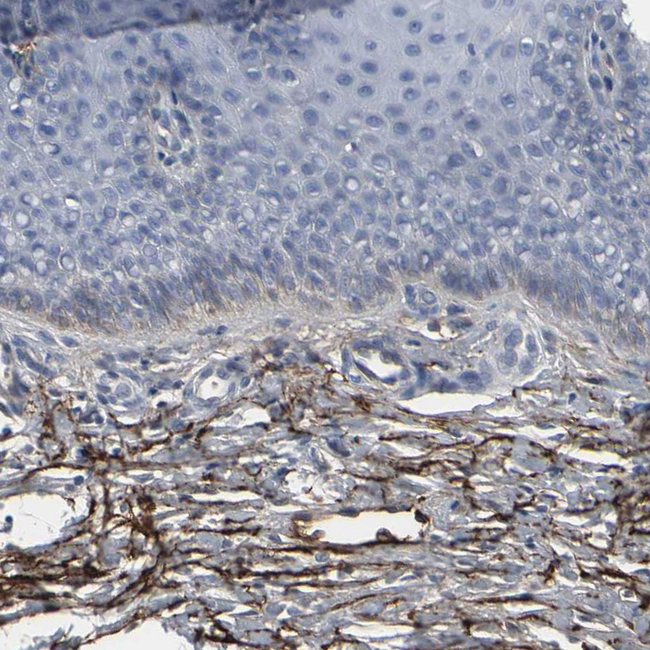 Versican Antibody in Immunohistochemistry (Paraffin) (IHC (P))
