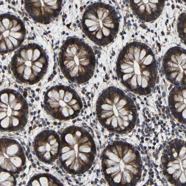 LPAR5 Antibody in Immunohistochemistry (Paraffin) (IHC (P))