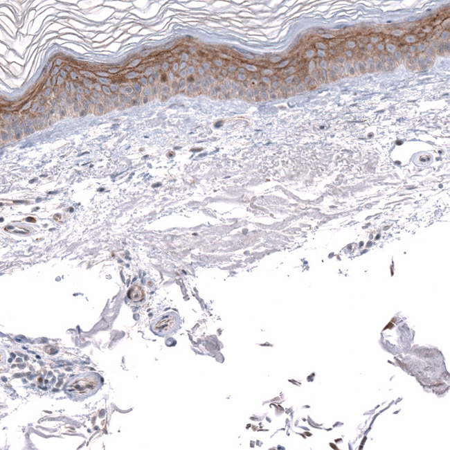MRGPRX2 Antibody in Immunohistochemistry (Paraffin) (IHC (P))
