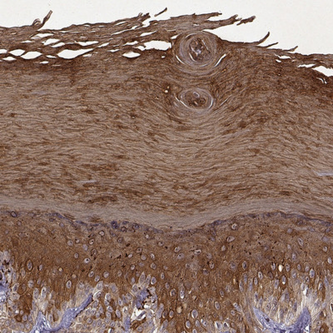 KRT9 Antibody in Immunohistochemistry (Paraffin) (IHC (P))