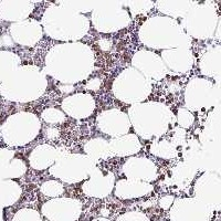 CLEC1B Antibody in Immunohistochemistry (Paraffin) (IHC (P))