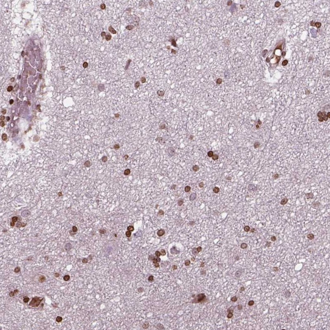 PIP4K2A Antibody in Immunohistochemistry (Paraffin) (IHC (P))