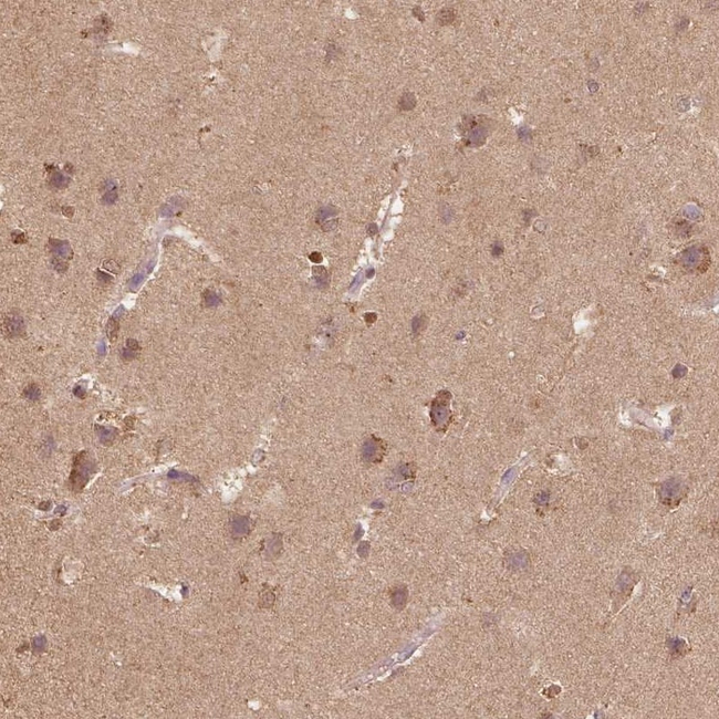 beta-1,2 Adaptin Antibody in Immunohistochemistry (Paraffin) (IHC (P))