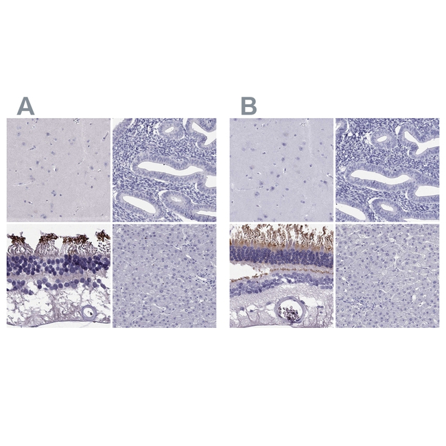 PDE6A Antibody in Immunohistochemistry (Paraffin) (IHC (P))