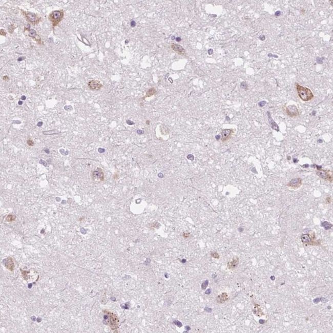 FZD5 Antibody in Immunohistochemistry (Paraffin) (IHC (P))