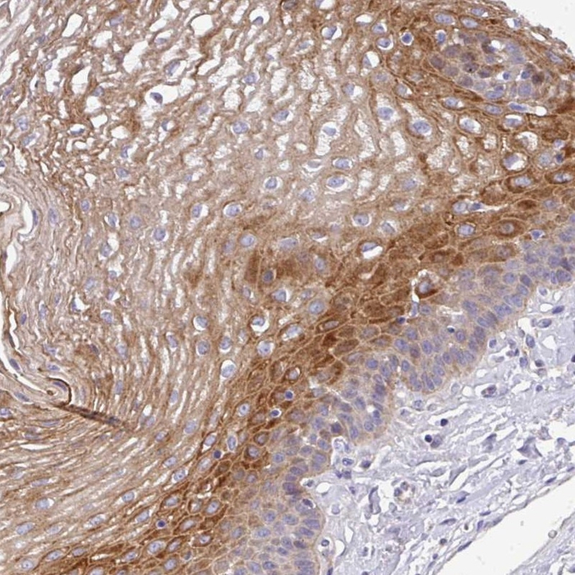 TMPRSS11D Antibody in Immunohistochemistry (Paraffin) (IHC (P))
