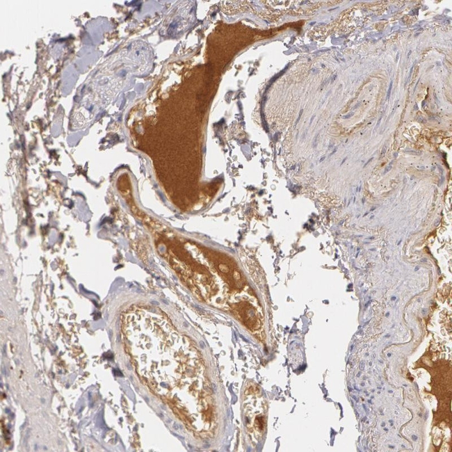 LBP Antibody in Immunohistochemistry (Paraffin) (IHC (P))