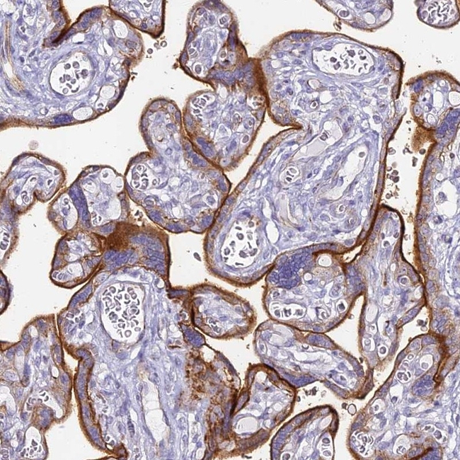 Intestinal Alkaline Phosphatase Antibody in Immunohistochemistry (Paraffin) (IHC (P))
