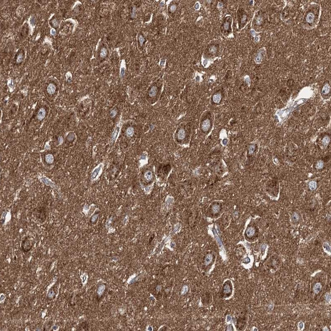 ADCY2 Antibody in Immunohistochemistry (Paraffin) (IHC (P))