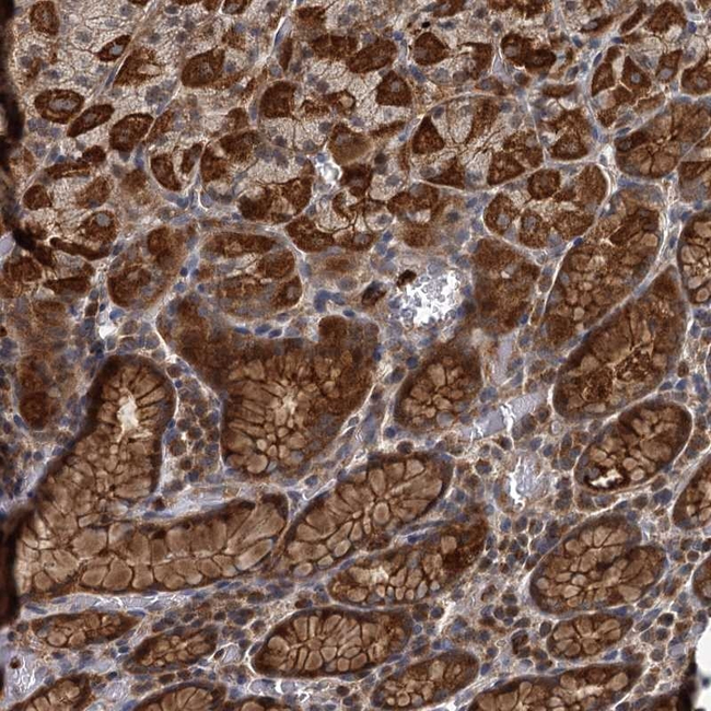 ADCY2 Antibody in Immunohistochemistry (Paraffin) (IHC (P))