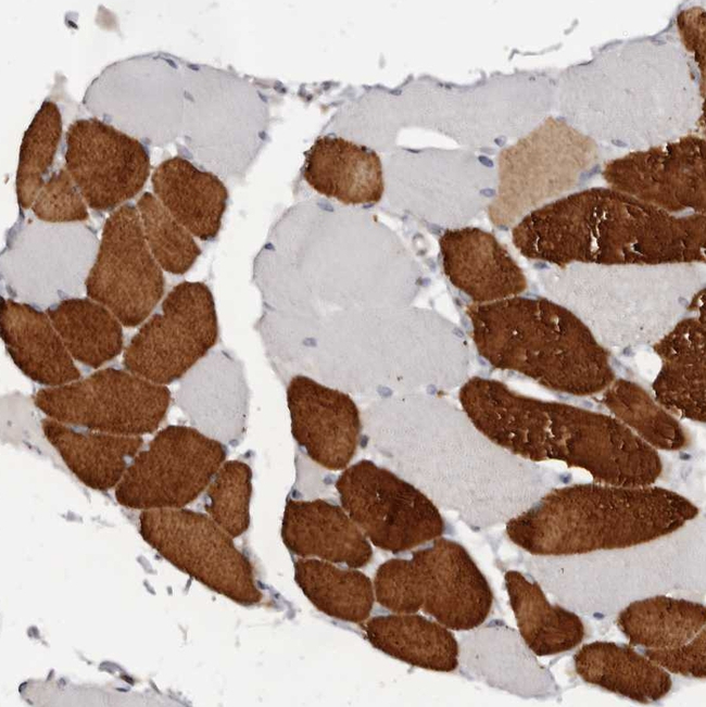 TNNI1 Antibody in Immunohistochemistry (Paraffin) (IHC (P))