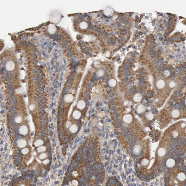 TOM1L1 Antibody in Immunohistochemistry (Paraffin) (IHC (P))