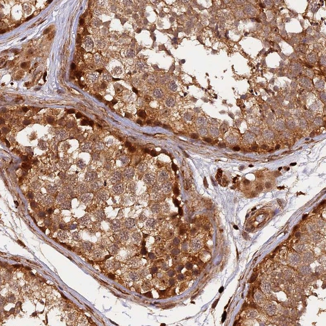 MMP15 Antibody in Immunohistochemistry (Paraffin) (IHC (P))